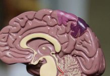 model of a brain